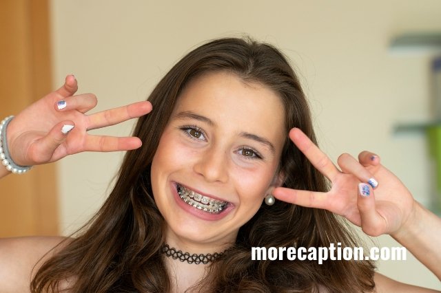 Funny Sayings About Braces Captions for Instagram
